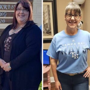 حقن مونجارو في الرياض